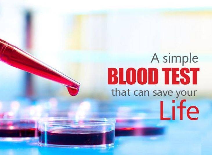 Essential Blood Test: What You Have To Know