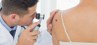 When To Check On Moles