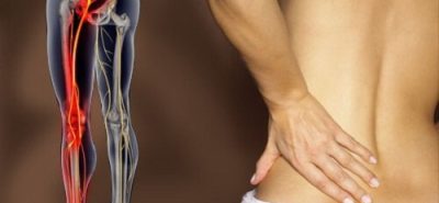 Lower Back Pain & Sciatica (Leg Pain)