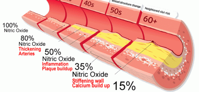 Nitric Oxide (NO) Boosters